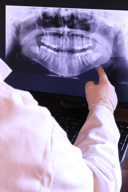 Best Root Canal Emergency Dentist  in Penn Estates, PA