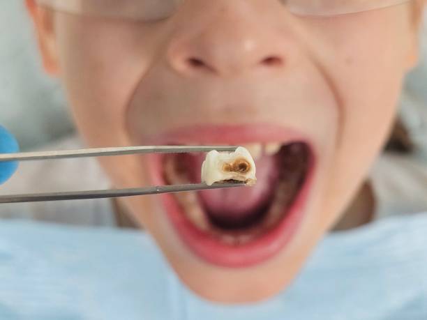 Best Dentist for Tooth Abscess  in Penn Estates, PA